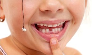 How to pull a tooth with no pain? Will a string do the honor?